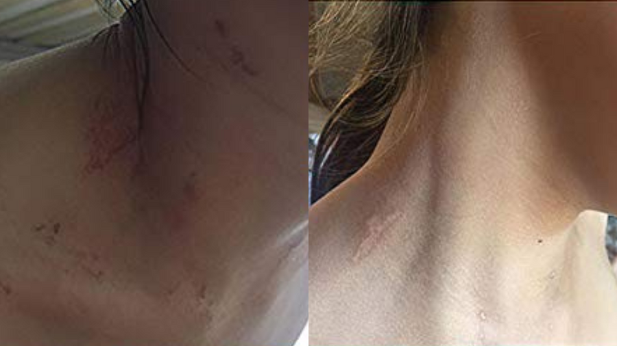 Before and after photo shared by a Lingon user
