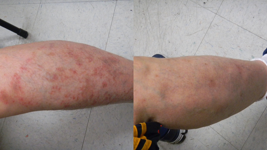 Before and after photo shared by a Lingon user