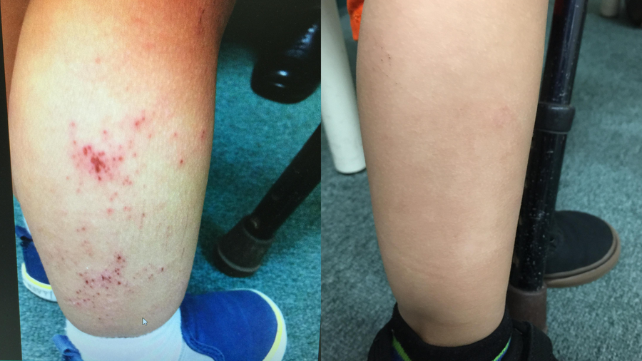 Before and after photo shared by a Lingon user