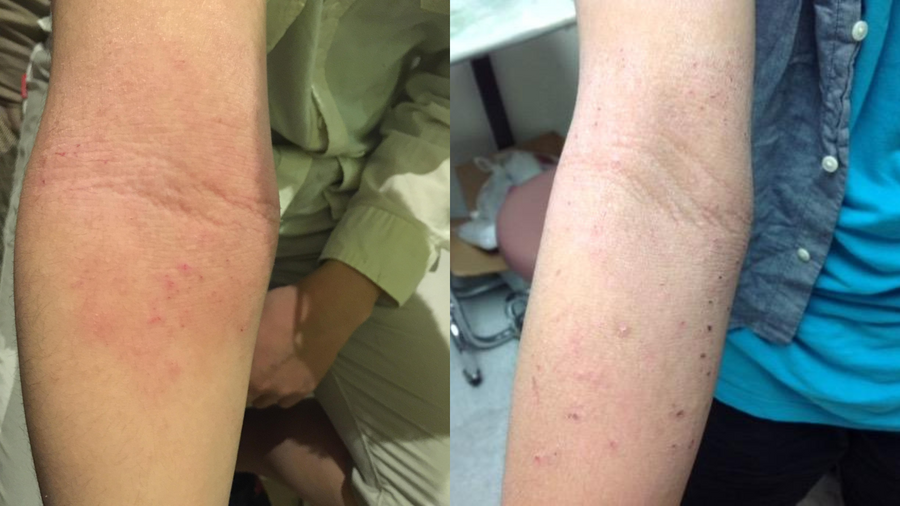 Before and after photo shared by a Lingon user