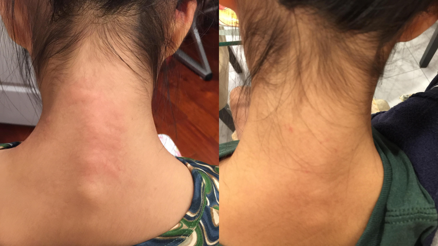 Before and after photo shared by a Lingon user