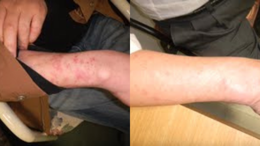 Before and after photo shared by a Lingon user