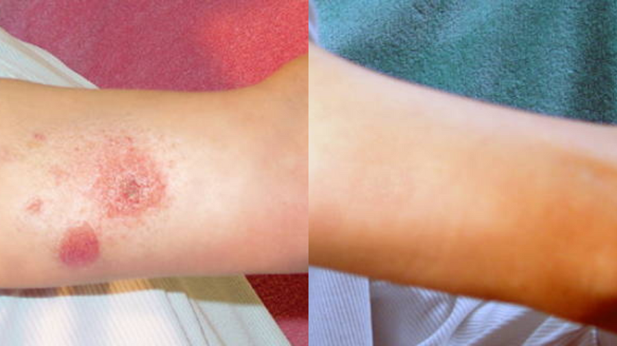 Before and after photo shared by a Lingon user