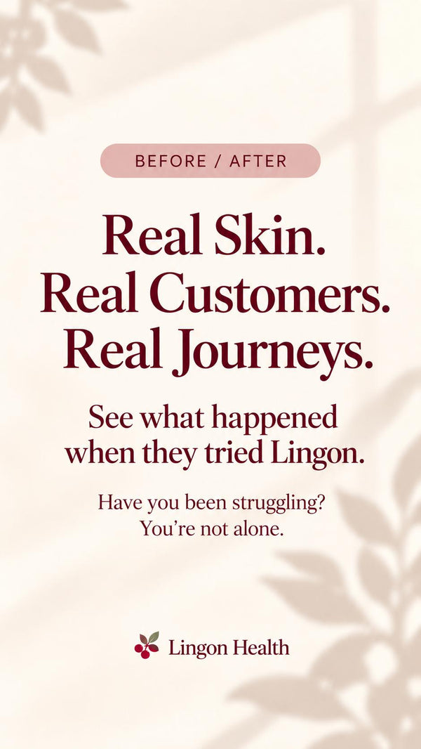 TikTok: real before and after photos shared by Lingon users