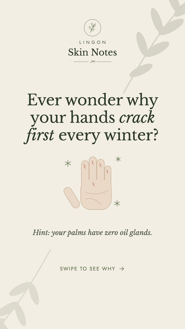 TikTok: Why do your hands crack first every winter?