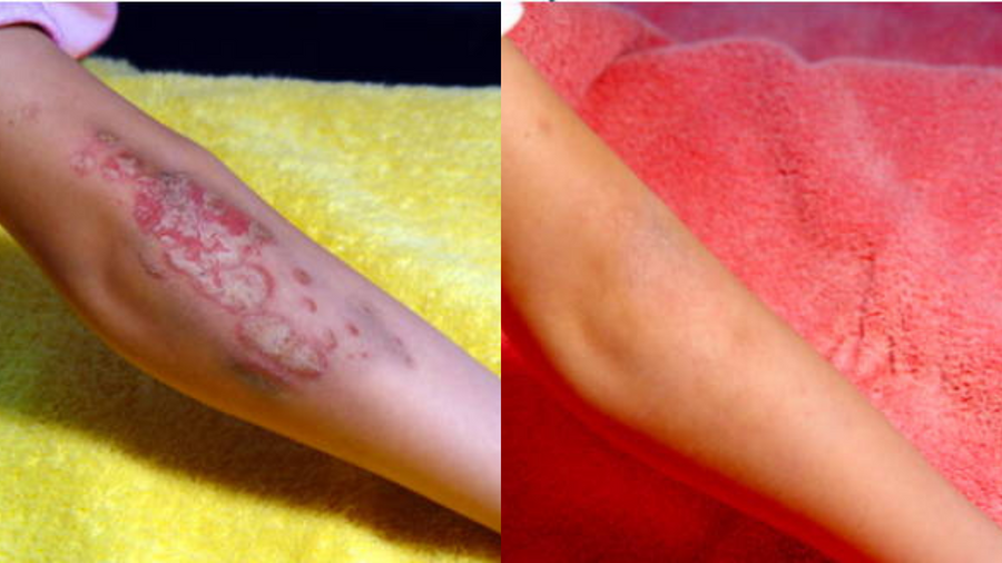 Before and after photo shared by a Lingon user