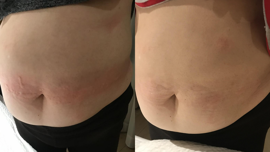 Before and after photo shared by a Lingon user