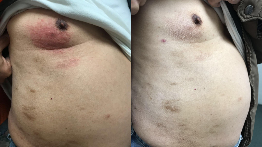 Before and after photo shared by a Lingon user