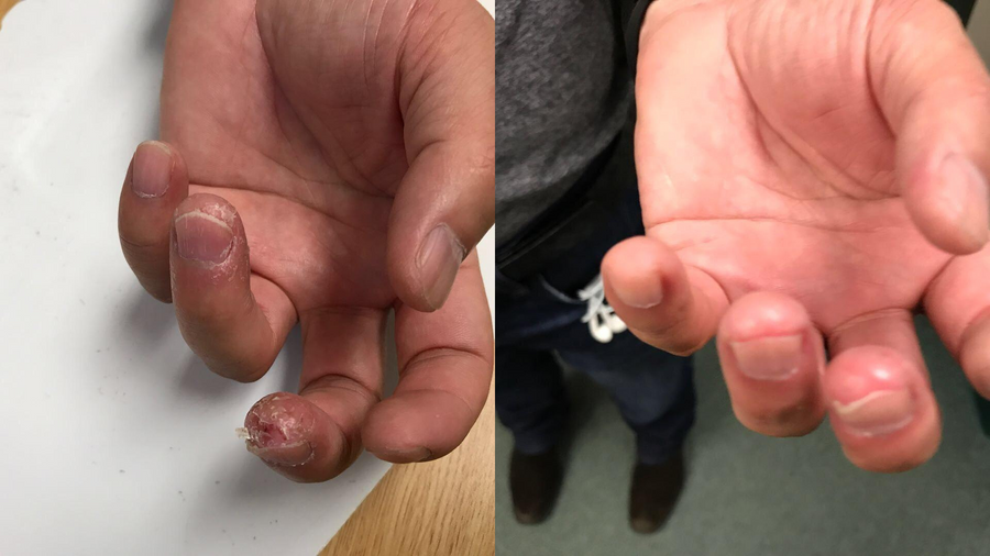 Before and after photo shared by a Lingon user