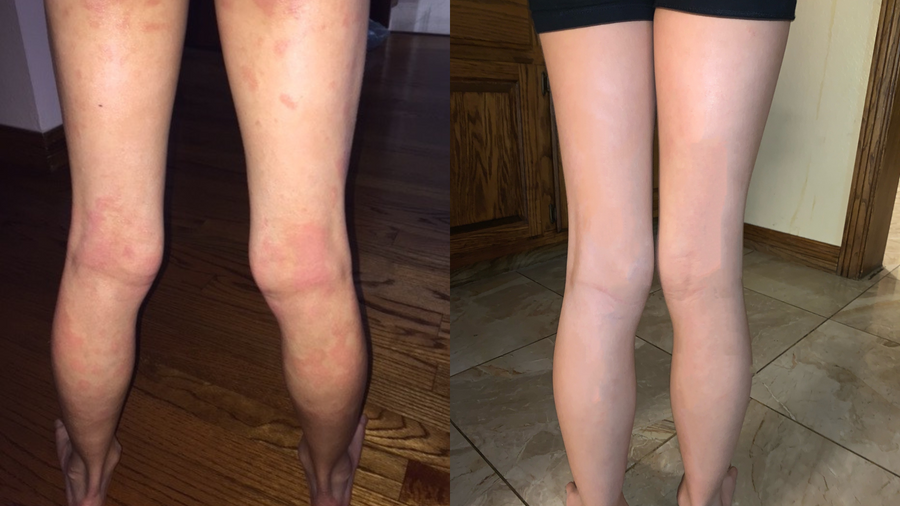 Before and after photo shared by a Lingon user